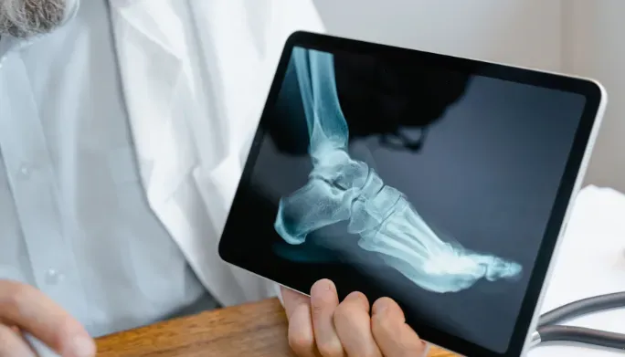 Bone Health at home in Grand Rapids